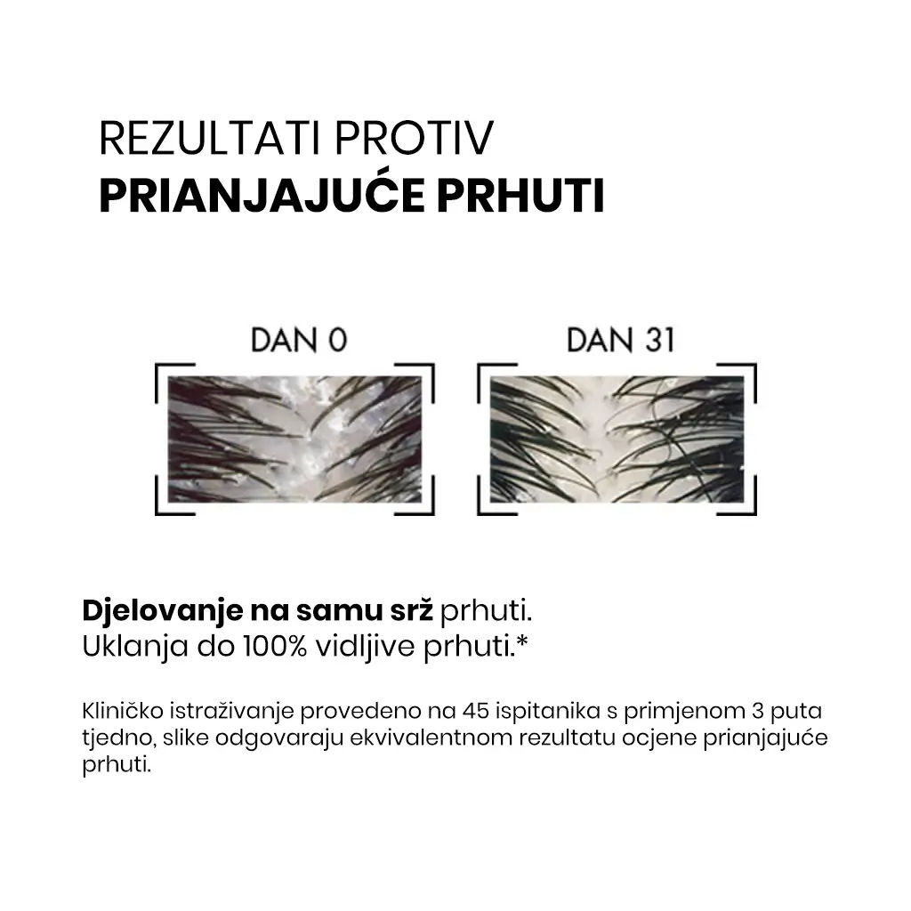 Dercos Anti-Dandruff Shampoo 3 Rezultati korištenja šampona protiv prhuti.